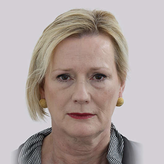 Dr Ha Facelift Before & After - Adelaide