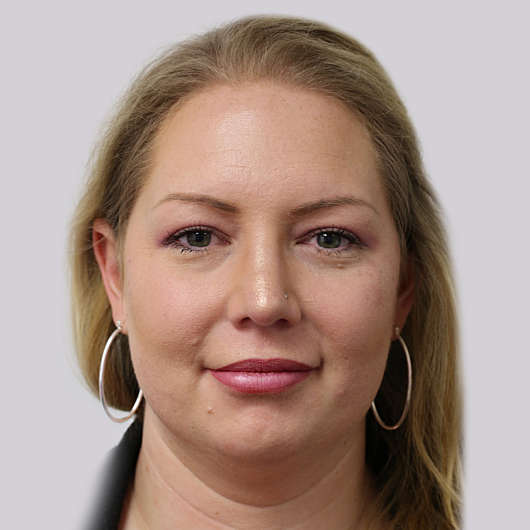 Dr Ha Rhinoplasty Before & After (Female) - Adelaide