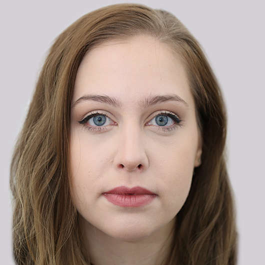 Dr Ha Rhinoplasty Before & After (Female) - Adelaide