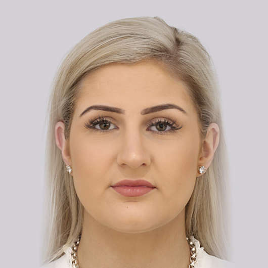 Dr Ha Rhinoplasty Before & After (Female) - Adelaide