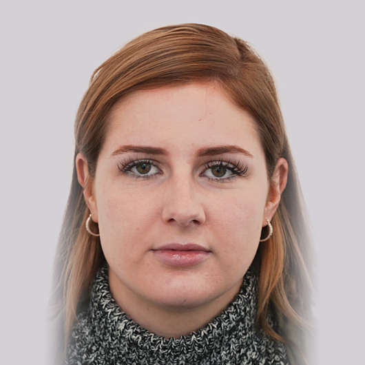 Dr Ha Rhinoplasty Before & After (Female) - Adelaide