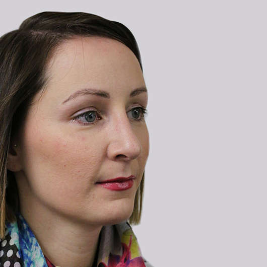 Dr Ha Rhinoplasty Before & After (Female) - Adelaide