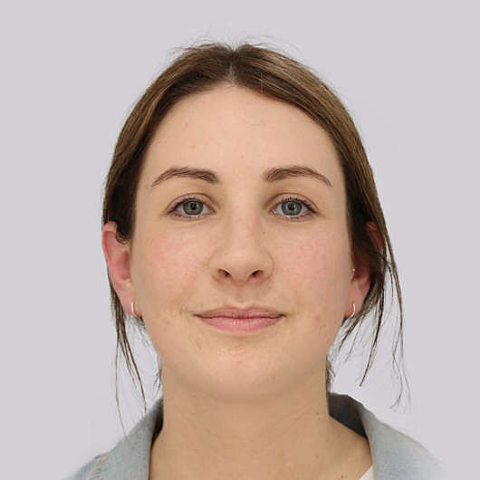 Dr Ha Rhinoplasty Before & After (Female) - Adelaide