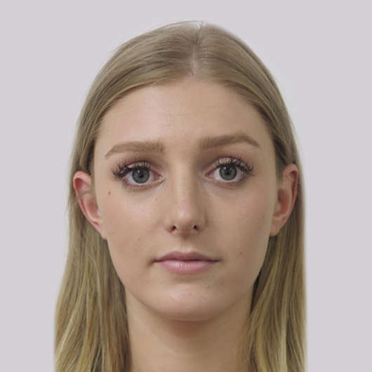 Dr Ha Rhinoplasty Before & After (Female) - Adelaide