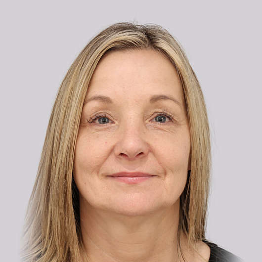 Dr Ha Rhinoplasty Before & After - Adelaide