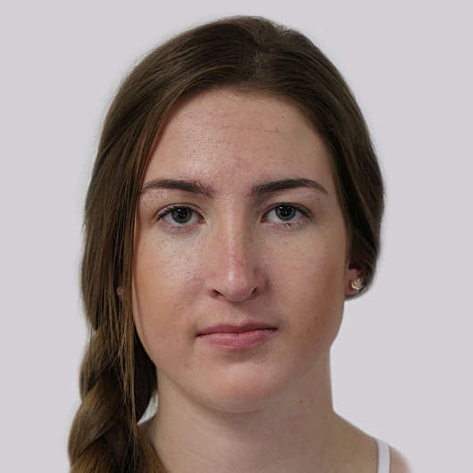 Dr Ha Rhinoplasty Before & After (Female) - Adelaide