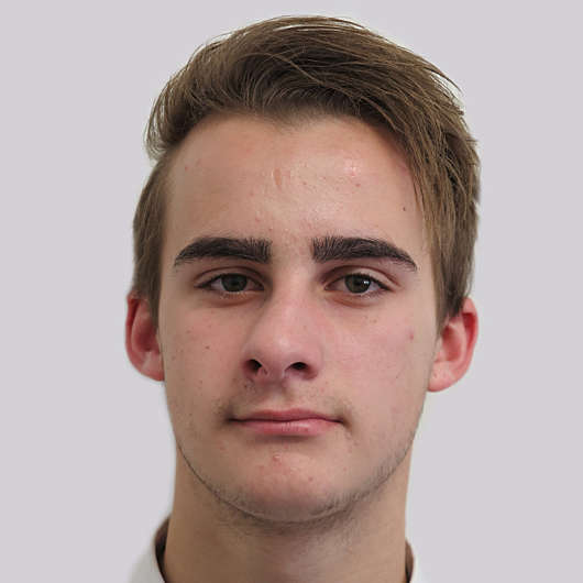 Dr Ha Rhinoplasty Before & After (Male) - Adelaide