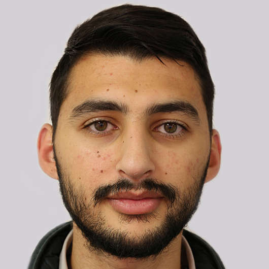 Dr Ha Rhinoplasty Before & After (Male) - Adelaide