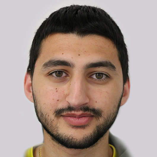 Dr Ha Rhinoplasty Before & After (Male) - Adelaide