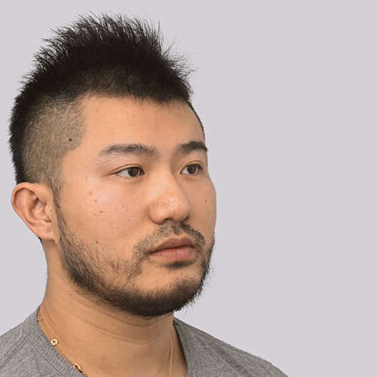 Dr Ha Rhinoplasty Before & After (Male) - Adelaide