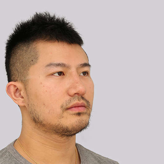 Dr Ha Rhinoplasty Before & After (Male) - Adelaide