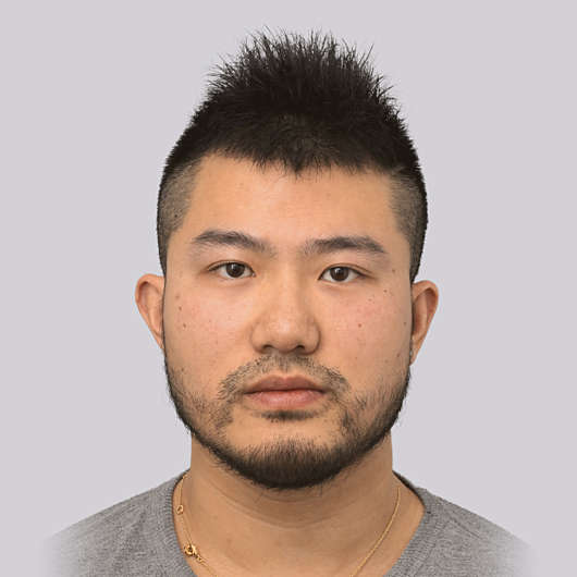 Dr Ha Rhinoplasty Before & After (Male) - Adelaide