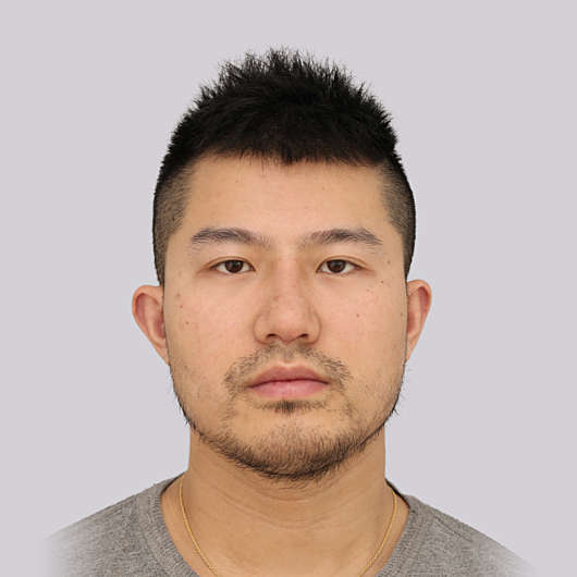 Dr Ha Rhinoplasty Before & After (Male) - Adelaide