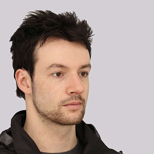 Dr Ha Rhinoplasty Before & After (Male) - Adelaide