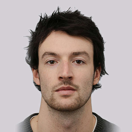 Dr Ha Rhinoplasty Before & After (Male) - Adelaide