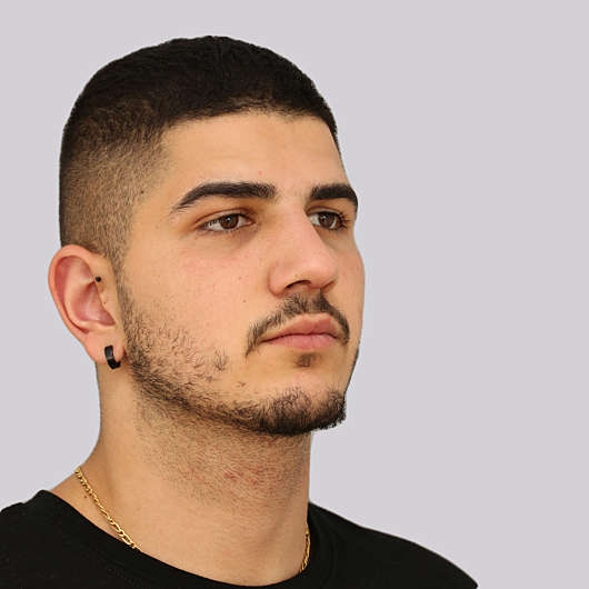 Dr Ha Rhinoplasty Before & After (Male) - Adelaide