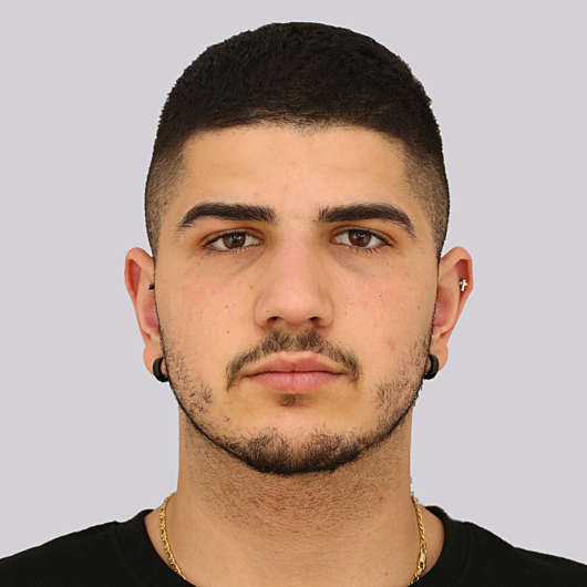 Dr Ha Rhinoplasty Before & After (Male) - Adelaide