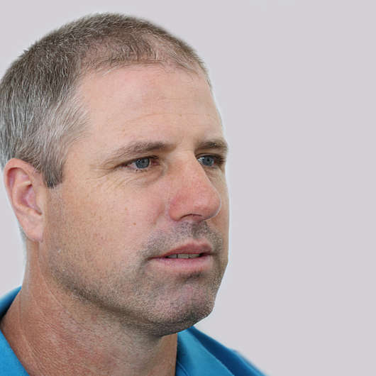 Dr Ha Rhinoplasty Before & After - Adelaide